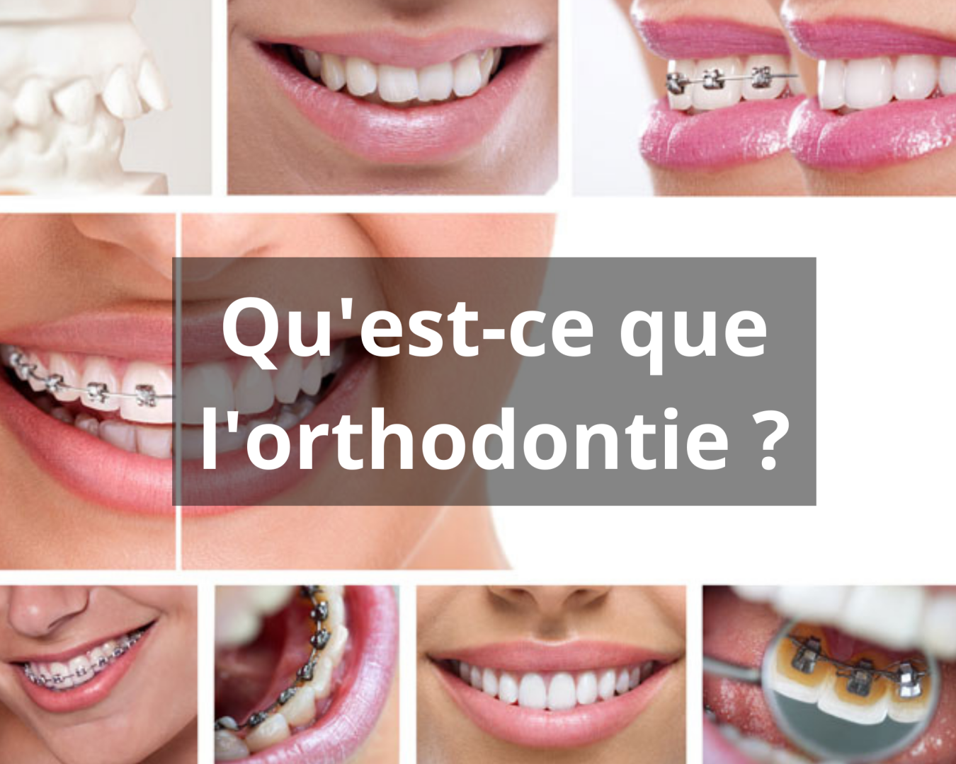 Qu'est-ce que l'orthodontie ?